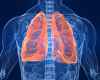lungs.jpg