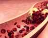 embryonic_stem_cell_prevent_atherosclerosis.jpg