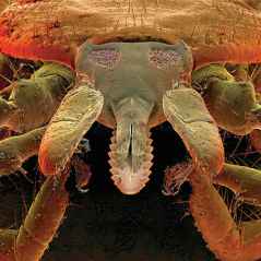 Lyme Disease