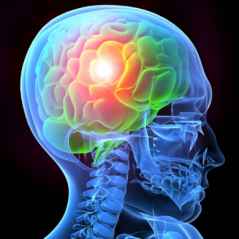 Brain Injury