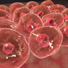 Scleroderma