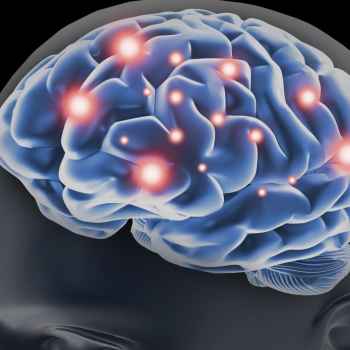 brain.jpg